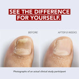Kerasal Fungal Nail Renewal