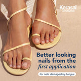 Kerasal Advanced Clear & Defend Fungal Nail Renewal