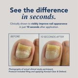 Kerasal Advanced Clear & Defend Fungal Nail Renewal