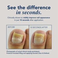 Kerasal Advanced Clear & Defend Fungal Nail Renewal