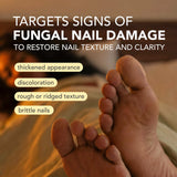 Kerasal Nighttime Renewal Fungal Nail Patches