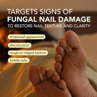 Kerasal Nighttime Renewal Fungal Nail Patches