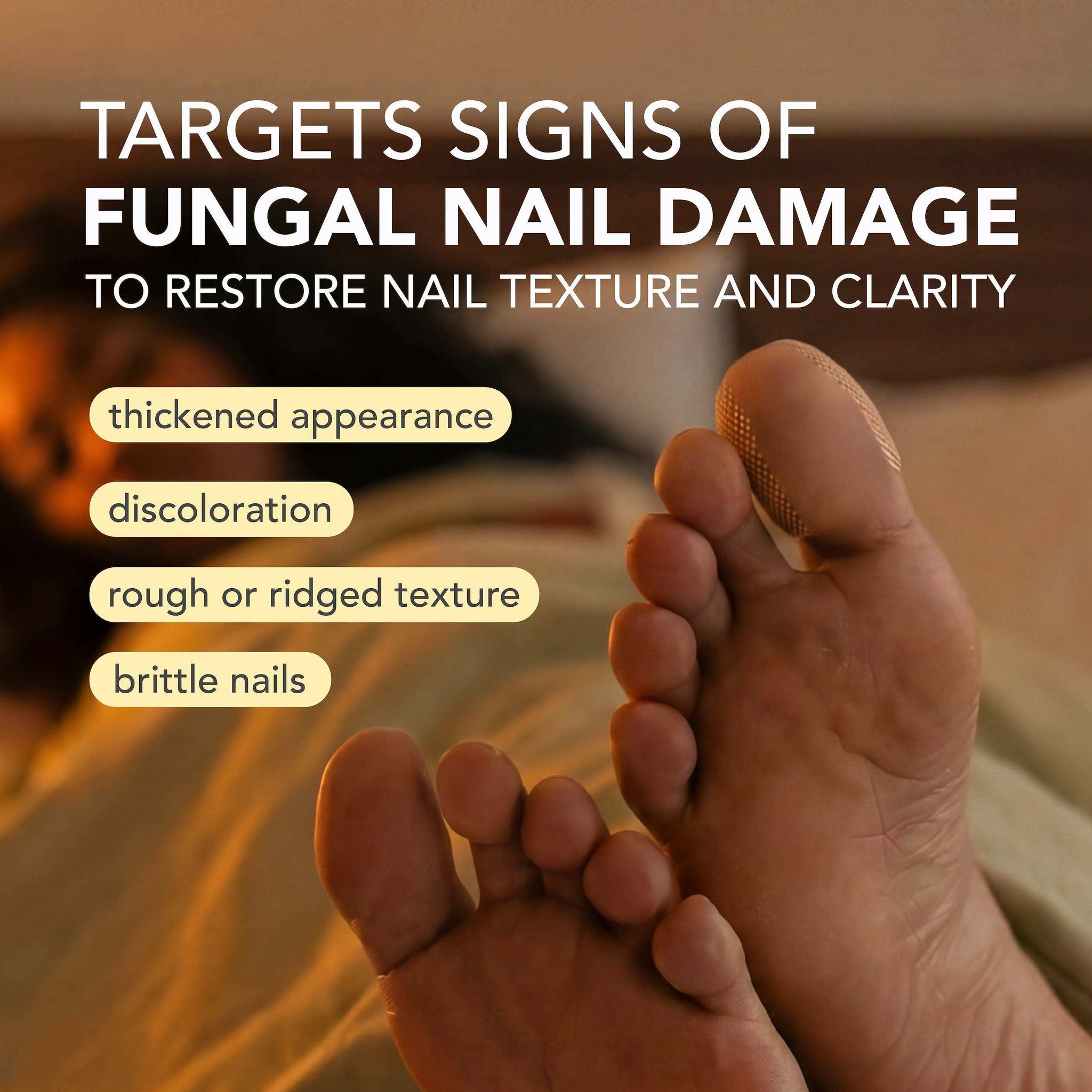 Kerasal Nighttime Renewal Fungal Nail Patches