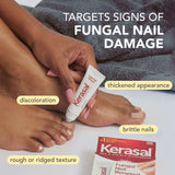 Kerasal Fungal Nail Renewal